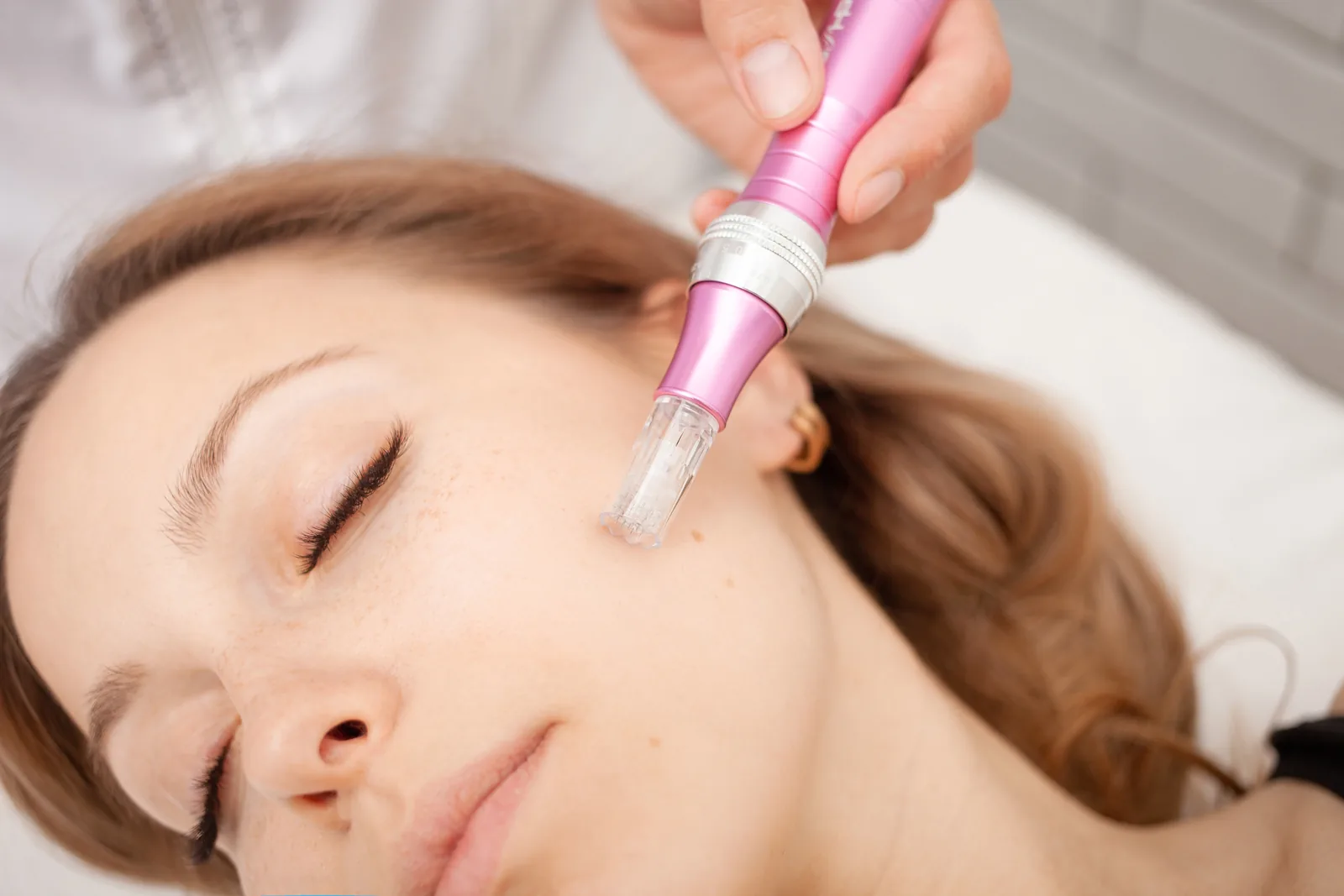 Skin Treatments & Tightening